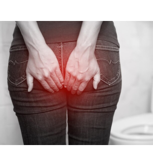 Analfissur